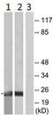 Serine And Arginine Rich Splicing Factor 3 antibody, ab125124, Abcam, Western Blot image 