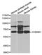 Cholinergic Receptor Nicotinic Beta 1 Subunit antibody, PA5-76704, Invitrogen Antibodies, Western Blot image 