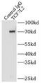 Transcription Factor 7 Like 2 antibody, FNab08556, FineTest, Immunoprecipitation image 