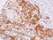 Cyclin Dependent Kinase 5 antibody, NBP2-15843, Novus Biologicals, Immunohistochemistry paraffin image 