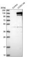 Coiled-Coil Domain Containing 146 antibody, PA5-54149, Invitrogen Antibodies, Western Blot image 