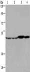 Fumarate Hydratase antibody, CSB-PA788032, Cusabio, Western Blot image 