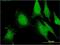 FGF1 Intracellular Binding Protein antibody, MA5-24425, Invitrogen Antibodies, Immunofluorescence image 
