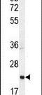 Achaete-Scute Family BHLH Transcription Factor 2 antibody, PA5-24456, Invitrogen Antibodies, Western Blot image 