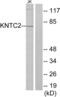 NDC80 Kinetochore Complex Component antibody, abx013276, Abbexa, Western Blot image 