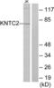 Kntc2 antibody, abx013276, Abbexa, Western Blot image 