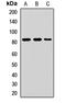 Minichromosome Maintenance Complex Component 7 antibody, LS-C667768, Lifespan Biosciences, Western Blot image 