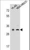 Serine Protease 3 antibody, LS-C162195, Lifespan Biosciences, Western Blot image 