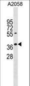 Apoptosis And Caspase Activation Inhibitor antibody, LS-C157569, Lifespan Biosciences, Western Blot image 