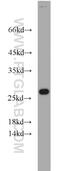 Ribosomal Protein L15 antibody, 16740-1-AP, Proteintech Group, Western Blot image 