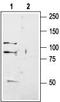 Glutamate Ionotropic Receptor Kainate Type Subunit 1 antibody, TA328827, Origene, Western Blot image 