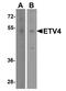ETS Variant 4 antibody, TA355020, Origene, Western Blot image 
