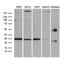 Clathrin Light Chain A antibody, M05796-1, Boster Biological Technology, Western Blot image 