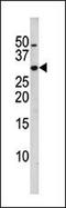 Cyclin Dependent Kinase Inhibitor 1B antibody, GTX17353, GeneTex, Western Blot image 