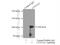 Catenin Alpha 3 antibody, 13974-1-AP, Proteintech Group, Immunoprecipitation image 