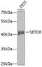 Lysine Methyltransferase 5A antibody, 19-554, ProSci, Western Blot image 