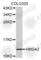 High Mobility Group AT-Hook 2 antibody, A2972, ABclonal Technology, Western Blot image 