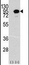 Aconitase 2 antibody, PA5-14500, Invitrogen Antibodies, Western Blot image 