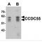 Nuclear Speckle Splicing Regulatory Protein 1 antibody, MBS151410, MyBioSource, Western Blot image 