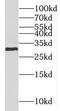 Methyltransferase Like 1 antibody, FNab05137, FineTest, Western Blot image 