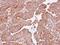 Isocitrate Dehydrogenase (NAD(+)) 3 Alpha antibody, NBP1-32396, Novus Biologicals, Immunohistochemistry paraffin image 