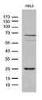 Nucleic Acid Binding Protein 1 antibody, M11516, Boster Biological Technology, Western Blot image 