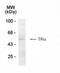 Thyroid Hormone Receptor Alpha antibody, NB200-318, Novus Biologicals, Western Blot image 
