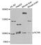 Aggrecan antibody, LS-C410071, Lifespan Biosciences, Western Blot image 