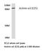 Actinin Alpha 3 (Gene/Pseudogene) antibody, LS-C176865, Lifespan Biosciences, Western Blot image 