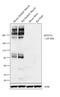 MYO7A antibody, PA1-936, Invitrogen Antibodies, Western Blot image 