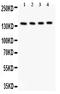 Insulin Receptor Substrate 2 antibody, PB9224, Boster Biological Technology, Western Blot image 