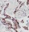 Phosphatase And Tensin Homolog antibody, FNab06912, FineTest, Immunohistochemistry paraffin image 