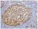 Cyclin Dependent Kinase 6 antibody, ab124821, Abcam, Immunohistochemistry paraffin image 