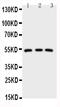 Interleukin 1 Receptor Associated Kinase 4 antibody, PA1942, Boster Biological Technology, Western Blot image 