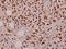 TNF-a antibody, A00002, Boster Biological Technology, Immunohistochemistry paraffin image 