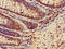 MutS Homolog 2 antibody, orb400604, Biorbyt, Immunohistochemistry paraffin image 