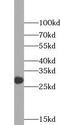 Thioredoxin Domain Containing 11 antibody, FNab09122, FineTest, Western Blot image 