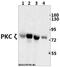 Protein Kinase C Zeta antibody, GTX66637, GeneTex, Western Blot image 