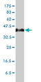 Serpin Family H Member 1 antibody, LS-C104879, Lifespan Biosciences, Western Blot image 