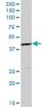 Mitogen-Activated Protein Kinase Kinase 4 antibody, H00006416-B01P, Novus Biologicals, Western Blot image 