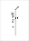 Haptoglobin antibody, LS-B13414, Lifespan Biosciences, Western Blot image 