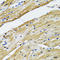 Glutamic-Oxaloacetic Transaminase 1 antibody, STJ28385, St John