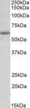 Cholinergic Receptor Nicotinic Epsilon Subunit antibody, 43-230, ProSci, Western Blot image 