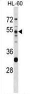 Serine Protease 16 antibody, AP53465PU-N, Origene, Western Blot image 