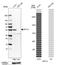 Keratin 13 antibody, NBP2-68890, Novus Biologicals, Western Blot image 