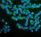 RAB1B, Member RAS Oncogene Family antibody, A04589-1, Boster Biological Technology, Immunofluorescence image 