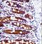 SRC Proto-Oncogene, Non-Receptor Tyrosine Kinase antibody, LS-C203762, Lifespan Biosciences, Immunohistochemistry frozen image 