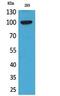 Ectonucleotide Pyrophosphatase/Phosphodiesterase 2 antibody, PA5-51105, Invitrogen Antibodies, Western Blot image 