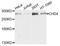 Chromodomain Helicase DNA Binding Protein 4 antibody, A11574, ABclonal Technology, Western Blot image 