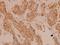 FOS Like 2, AP-1 Transcription Factor Subunit antibody, A02615S301, Boster Biological Technology, Immunohistochemistry paraffin image 